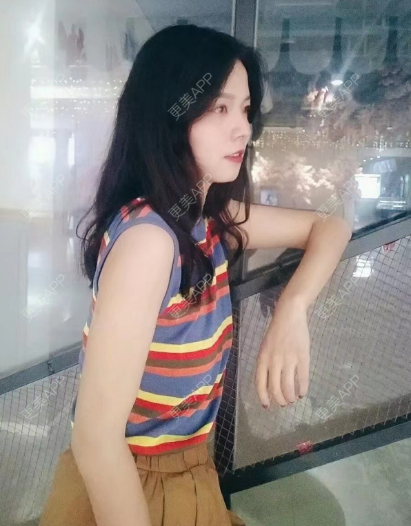 更美 - 更美用户8cGlQgtMJv的超声溶脂瘦腹部经验 | 超声溶脂瘦腹部 | 超声溶脂