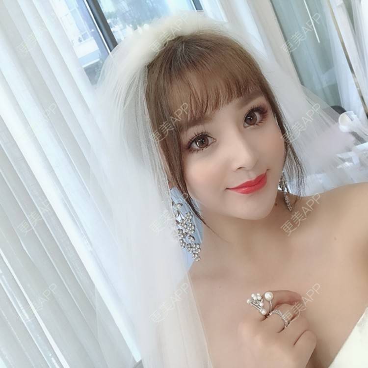 更美 - 思涵baby的鼻部多项经验 | 深圳 | 鼻部多项