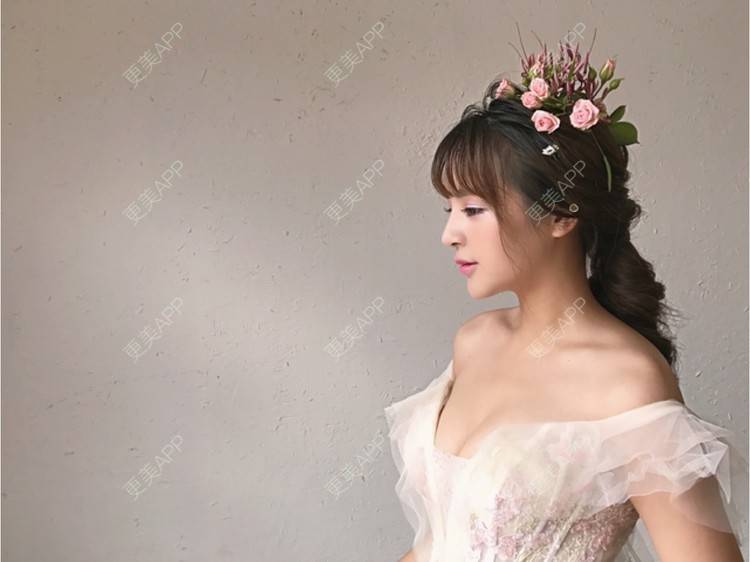 更美 - 思涵baby的鼻部多项经验 | 深圳 | 鼻部多项