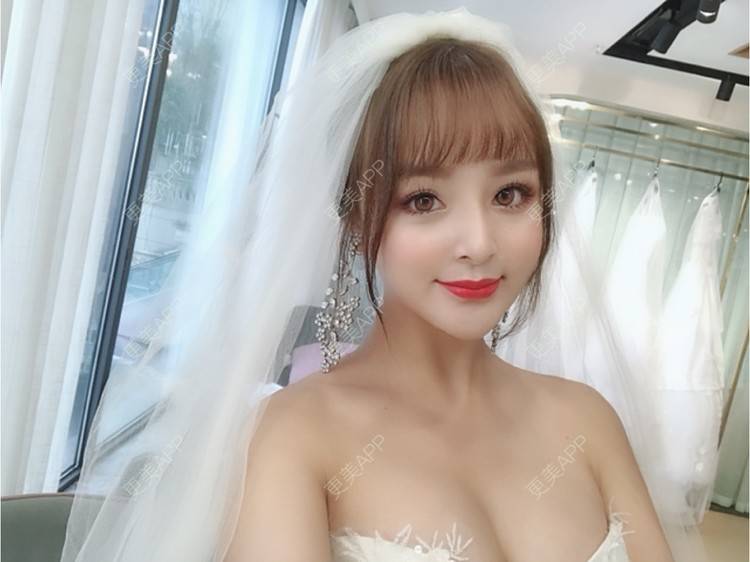 更美 - 思涵baby的鼻部多项经验 | 深圳 | 鼻部多项