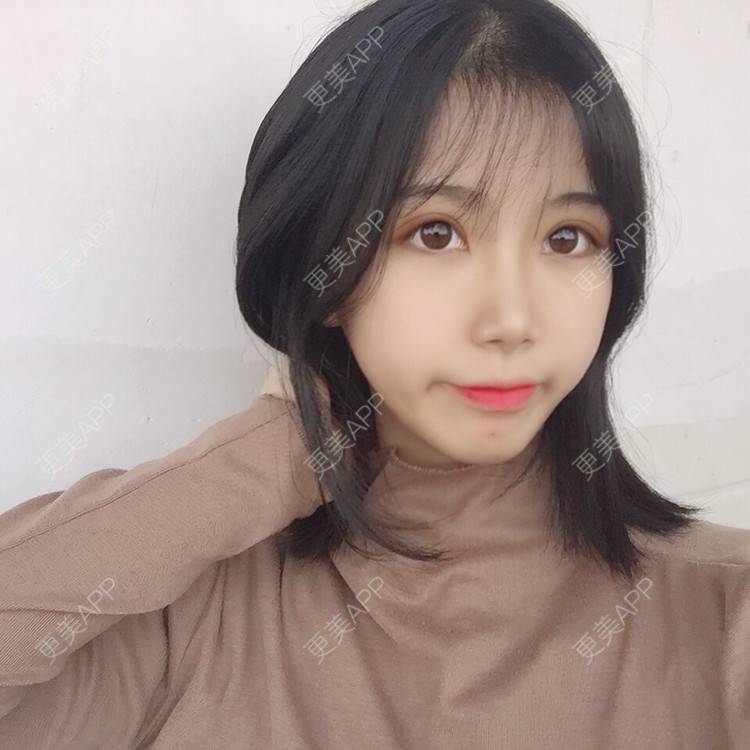 更美 - 更美用户5BT75lvkBb的热玛吉经验 | 广州 | 热玛吉