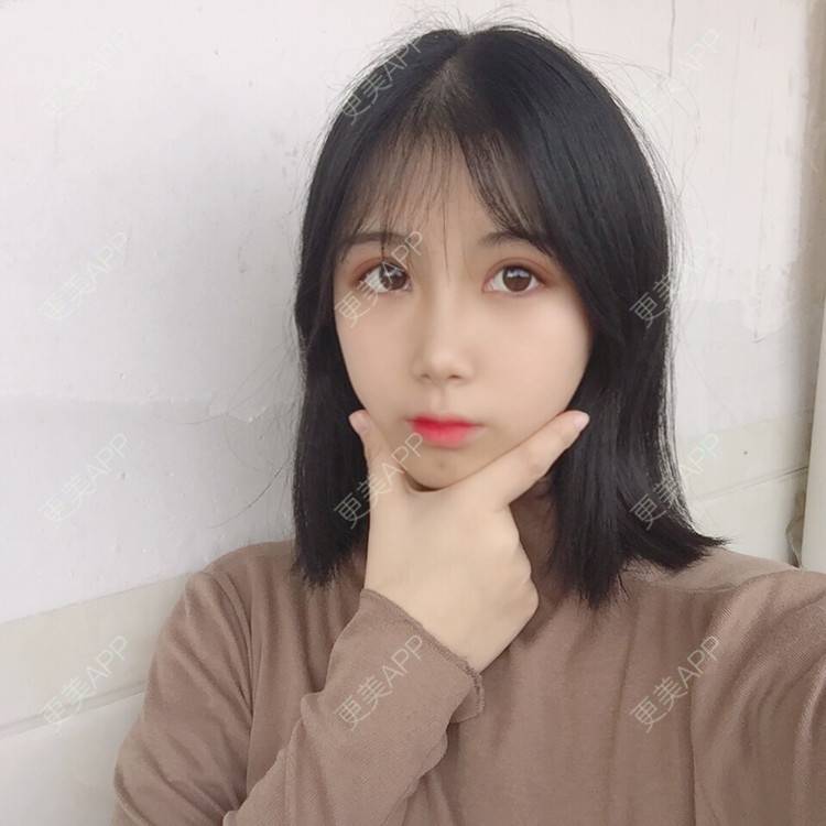 更美 - 更美用户5BT75lvkBb的热玛吉经验 | 广州 | 热玛吉