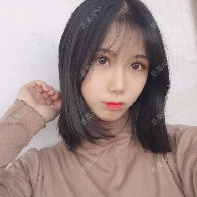 更美 - 更美用户5BT75lvkBb的热玛吉经验 | 广州 | 热玛吉