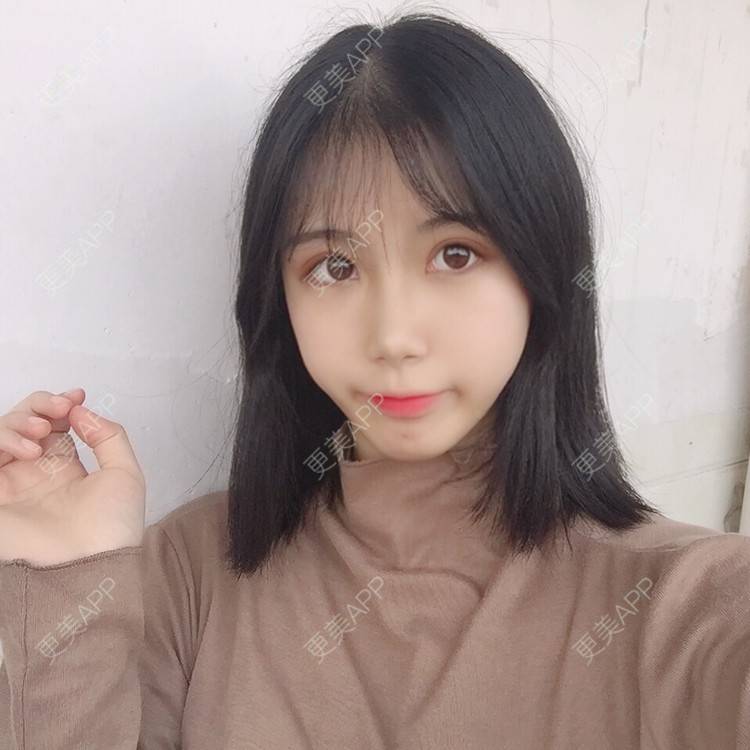 更美 - 更美用户5BT75lvkBb的热玛吉经验 | 广州 | 热玛吉