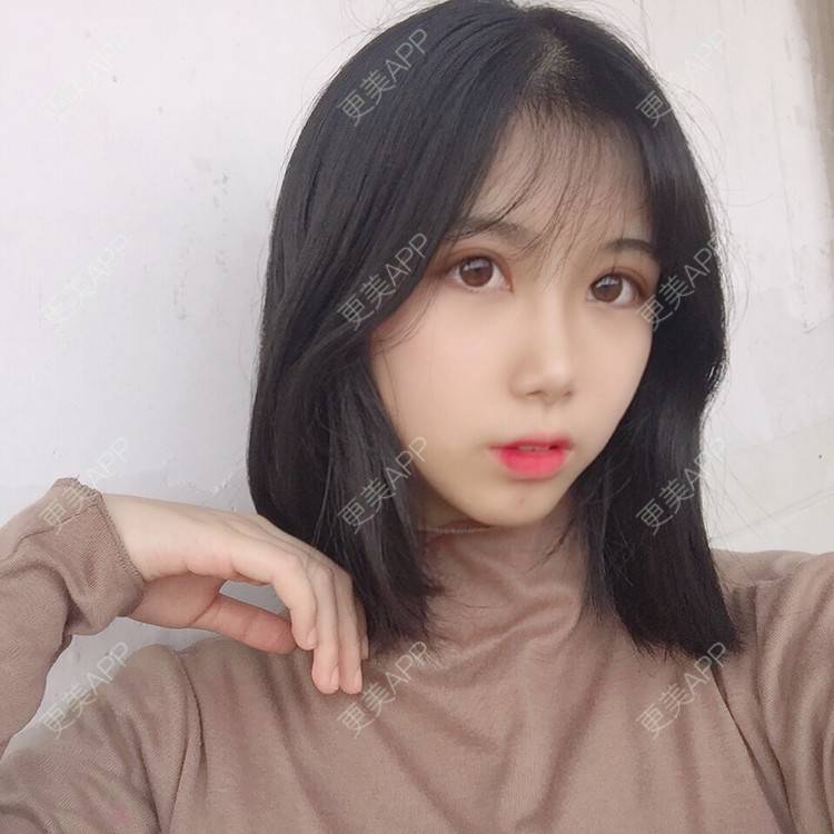 更美 - 更美用户5BT75lvkBb的热玛吉经验 | 广州 | 热玛吉