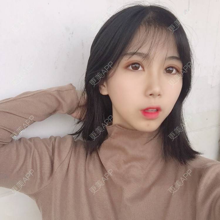 更美 - 更美用户5BT75lvkBb的热玛吉经验 | 广州 | 热玛吉