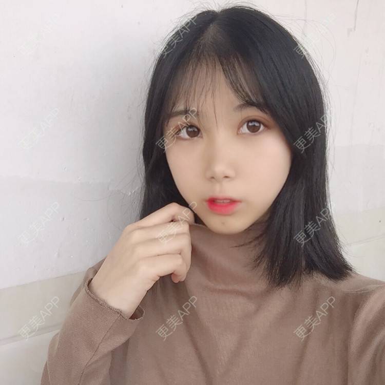 更美 - 更美用户5BT75lvkBb的热玛吉经验 | 广州 | 热玛吉