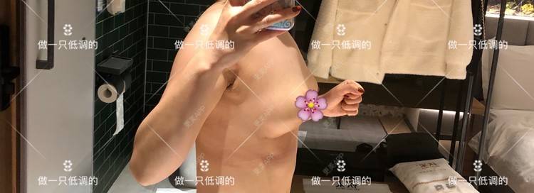 更美 - 更美用户ZN5LsrY6bk的乳晕缩小经验 | 乳晕缩小 | 缩胸手术 | 胸部下垂矫正 | 杭州