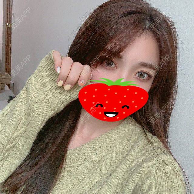 更美 - 无妨翰的膨体垫眉弓经验 | 膨体垫眉弓 | 上海