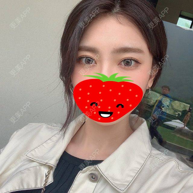 更美 - 无妨翰的膨体垫眉弓经验 | 膨体垫眉弓 | 上海