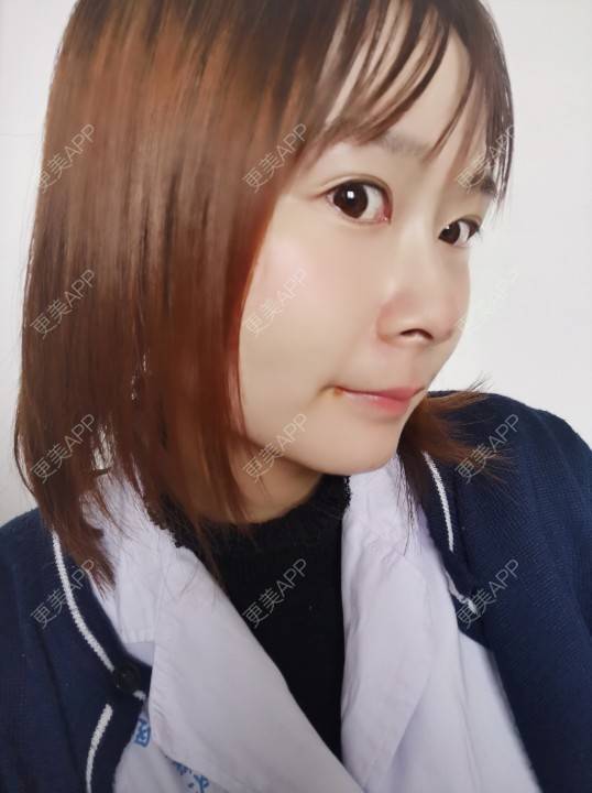 更美 - 更美用户srpv6JiXYY的玻尿酸苹果肌经验 | 玻尿酸苹果肌 | 上海