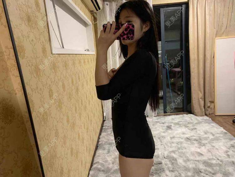 更美 - 尼卡挖土豆的背部吸脂经验 | 吸脂 | 背部吸脂 | 腰部吸脂 | 腹部吸脂 | 肩部吸脂 | 吸脂瘦大腿 | 手臂吸脂
