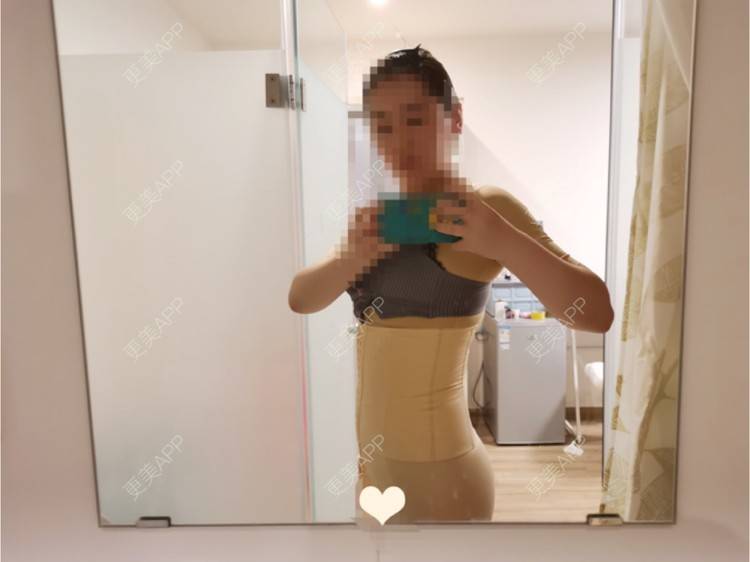 更美 - 更美用户U4weuuOb0x的吸脂去副乳经验 | 吸脂去副乳 | 北京