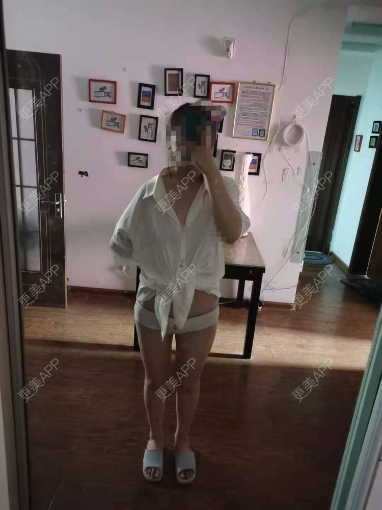 更美 - 更美用户U4weuuOb0x的吸脂去副乳经验 | 北京 | 吸脂去副乳