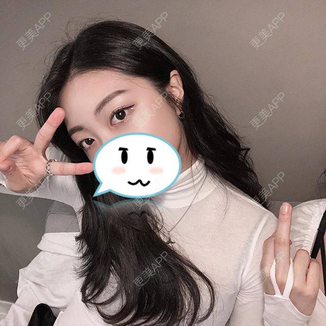 更美 - 银海属于天朝阿！顾的膨体垫眉弓经验 | 膨体垫眉弓 | 上海