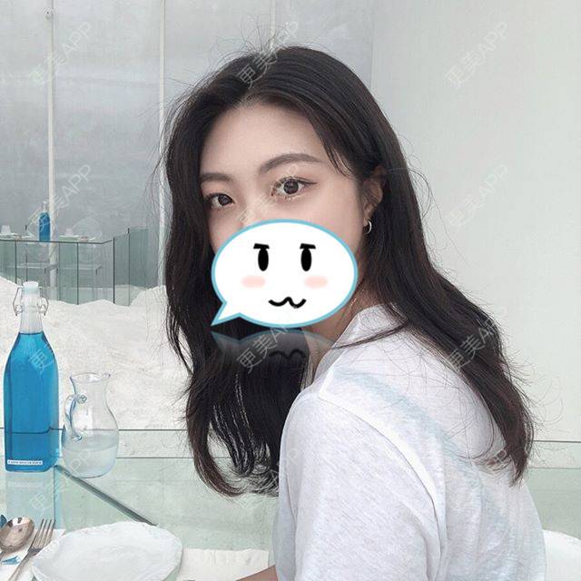 更美 - 银海属于天朝阿！顾的膨体垫眉弓经验 | 膨体垫眉弓 | 上海