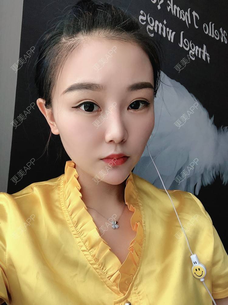 更美 - 更美用户wOARiRO1Ls的真皮丰卧蚕经验 | 北京 | 真皮丰卧蚕