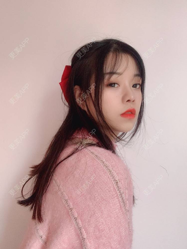 更美 - TAOYE`的颧骨内推经验 | 颧骨内推 | 下颌角 | 成都 | V脸套餐 | 下颌角切除