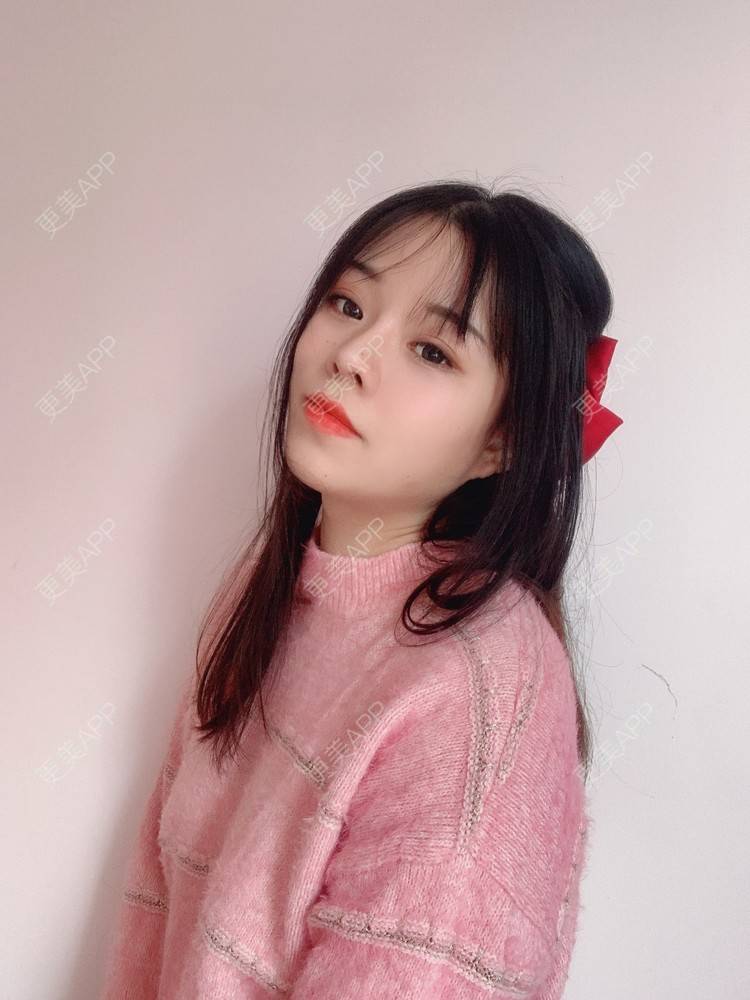 更美 - TAOYE`的颧骨内推经验 | 颧骨内推 | 下颌角 | 成都 | V脸套餐 | 下颌角切除