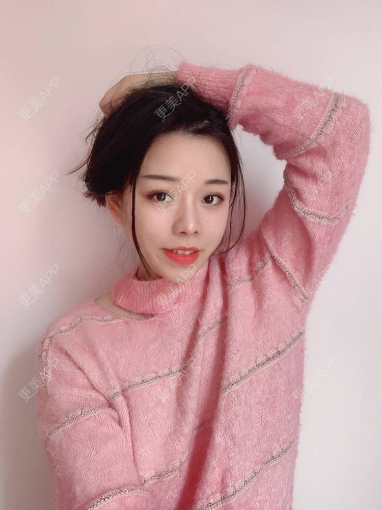 更美 - TAOYE`的颧骨内推经验 | 颧骨内推 | 下颌角 | 成都 | V脸套餐 | 下颌角切除