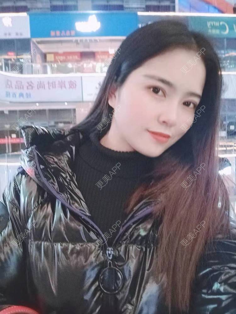 更美 - 更美用户uK1ce6rfue的全切双眼皮经验 | 广州 | 全切双眼皮