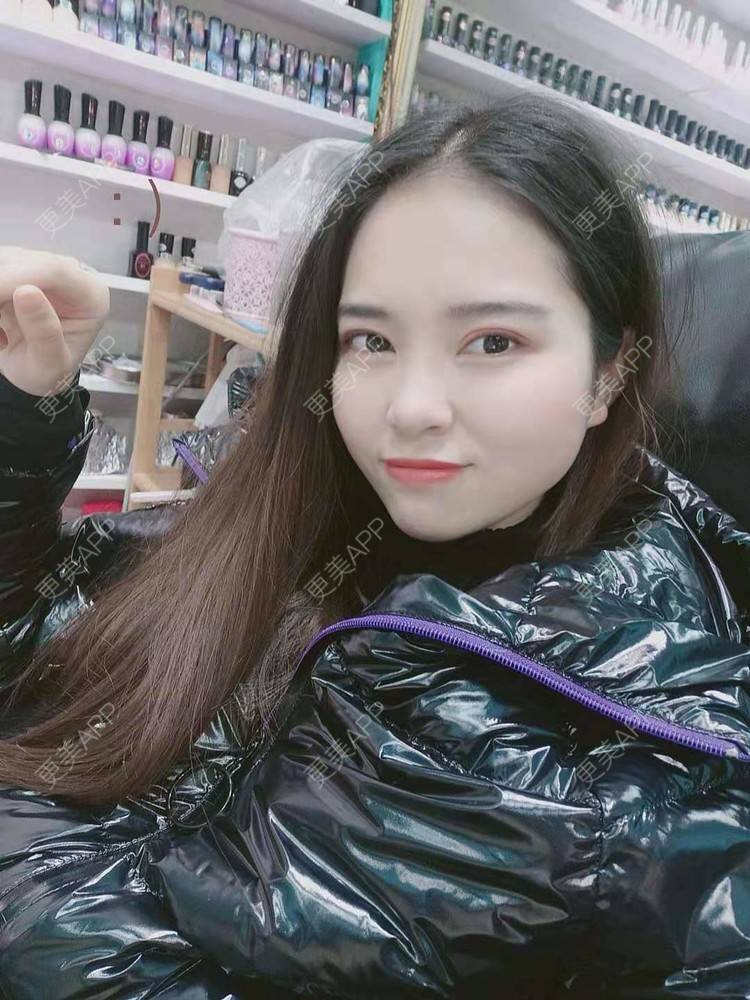 更美 - 更美用户uK1ce6rfue的全切双眼皮经验 | 广州 | 全切双眼皮