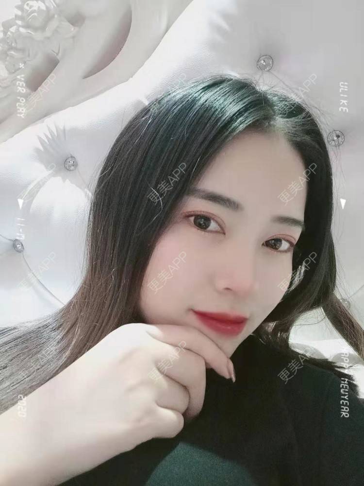 更美 - 更美用户uK1ce6rfue的全切双眼皮经验 | 广州 | 全切双眼皮