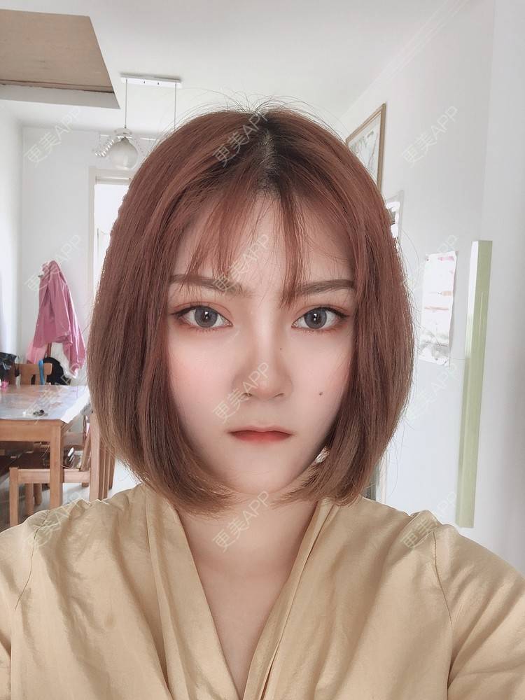 更美 - 你这只丑陋的土拨鼠的自体脂肪丰卧蚕经验 | 自体脂肪丰卧蚕
