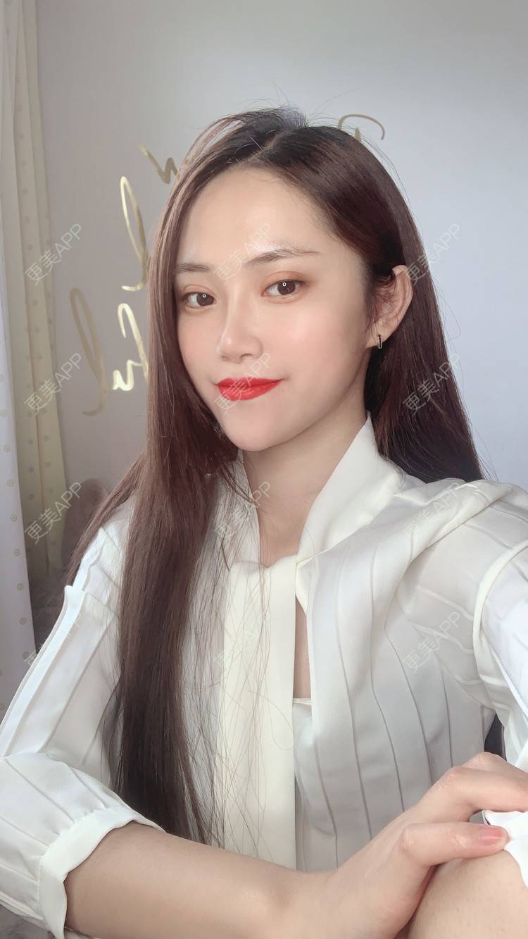 更美 - 更美用户a57Gmb9zHu的轮廓修复术经验 | 拉皮 | 郑州 | 轮廓修复术