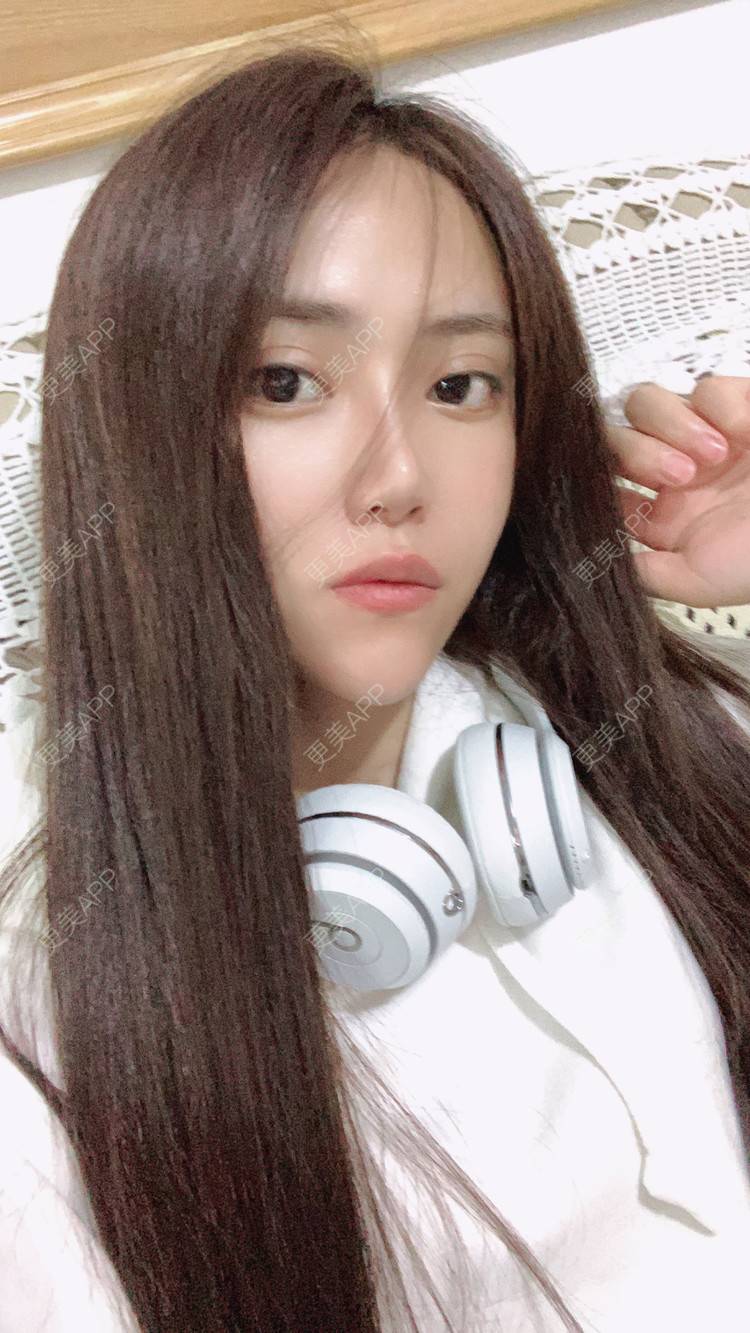 更美 - 更美用户a57Gmb9zHu的轮廓修复术经验 | 拉皮 | 郑州 | 轮廓修复术