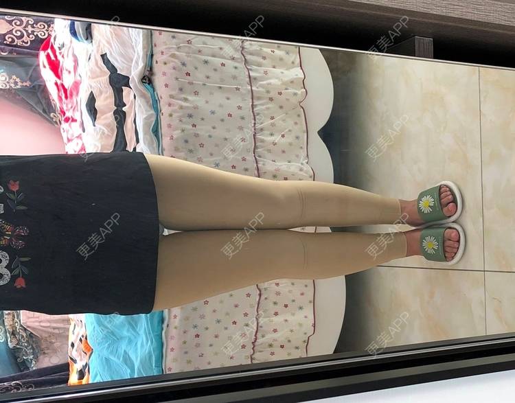 更美 - 更美用户0KW89OwG5c的吸脂去副乳经验 | 北京 | 吸脂去副乳