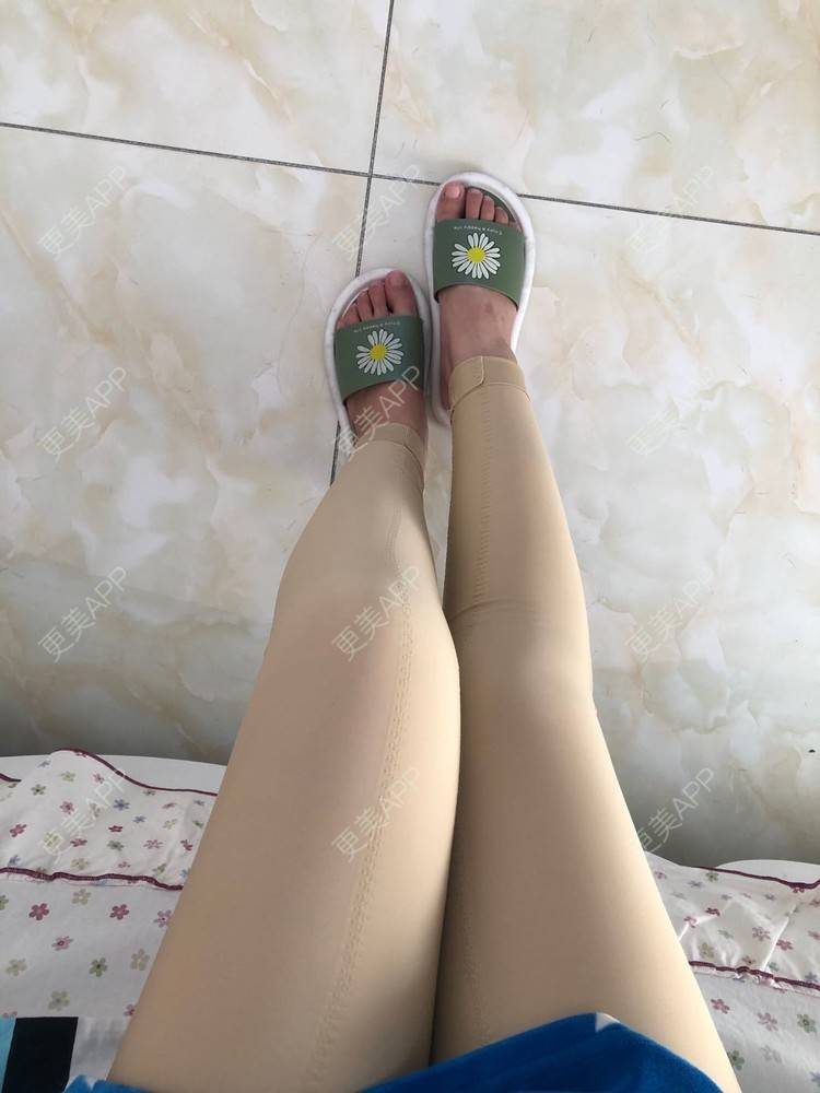 更美 - 更美用户0KW89OwG5c的吸脂去副乳经验 | 北京 | 吸脂去副乳