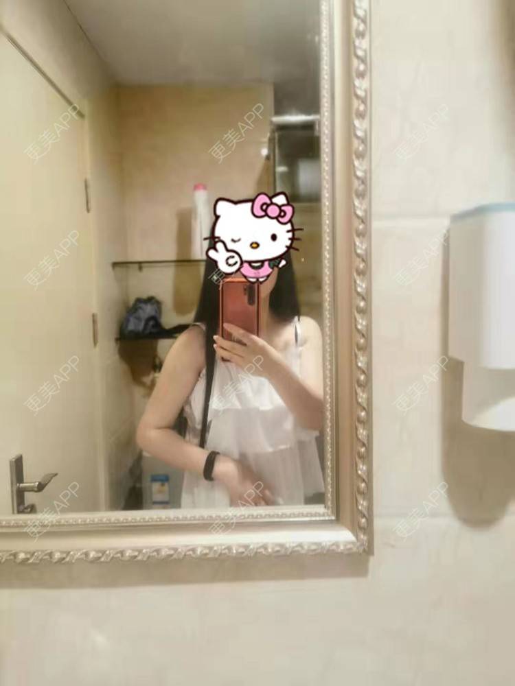 更美 - 更美用户jHjijlJNxV的手臂吸脂经验 | 手臂吸脂 | 广州