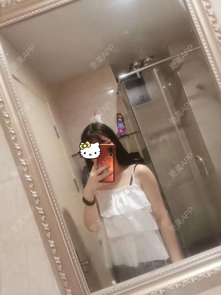 更美 - 更美用户jHjijlJNxV的手臂吸脂经验 | 手臂吸脂 | 广州