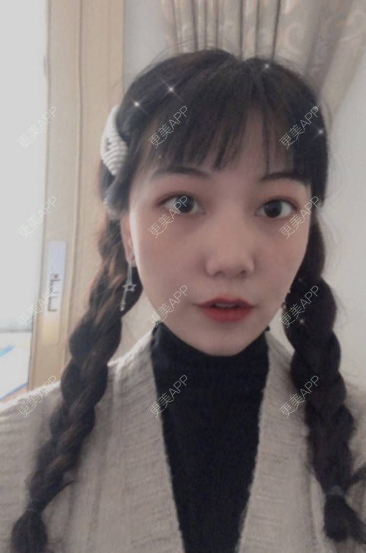 更美 - 更美用户IQRYoT8Qi3的经验 | 广州