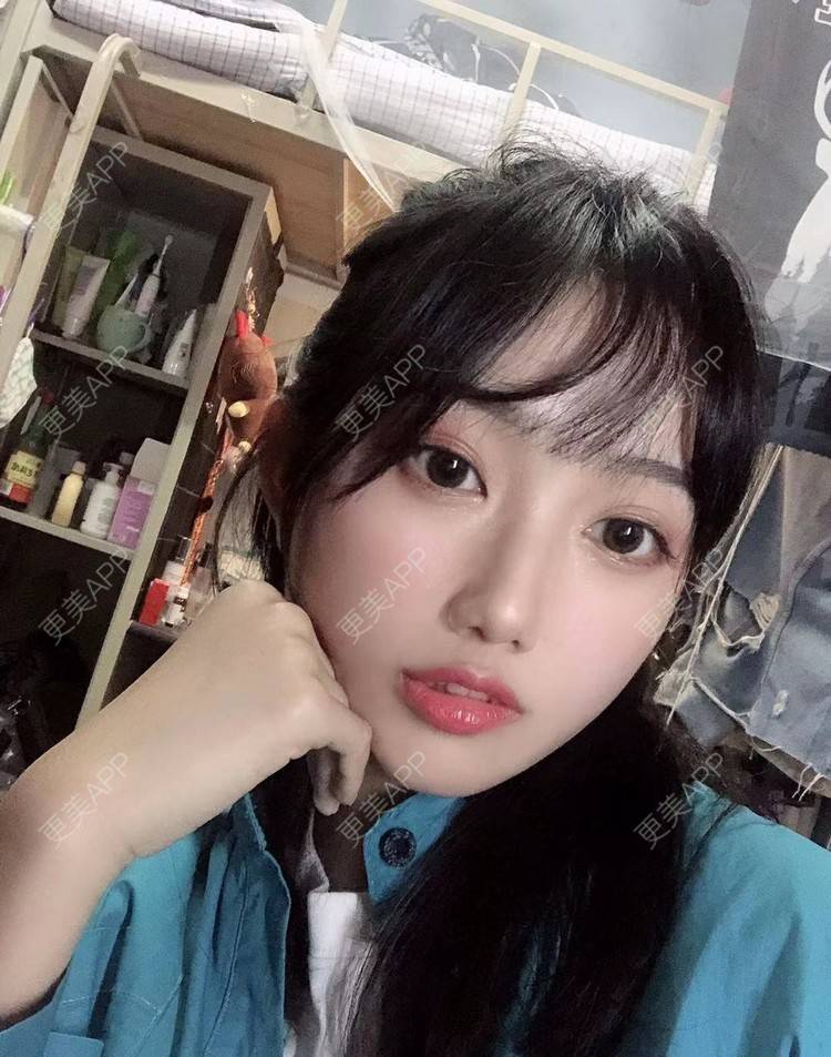 更美 - 不远行的埋线提升经验 | 埋线提升 | 南昌