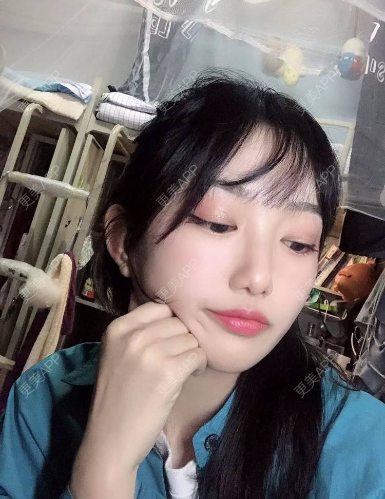 更美 - 不远行的埋线提升经验 | 埋线提升 | 南昌