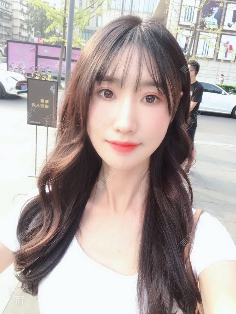 更美 - 更美用户rRiqiy6IDF的眼部多项经验 | 眼部多项 | 广州