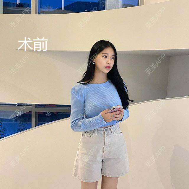 更美 - 更美用户2cP6DnDXAS的冷冻减脂瘦腹部经验 | 冷冻减脂瘦腹部 | 冷冻减脂瘦腹部 | 重庆