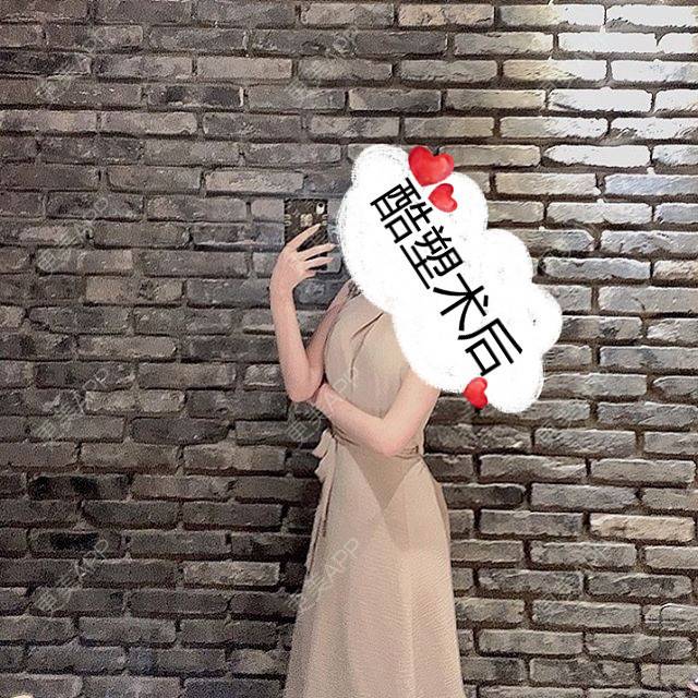 更美 - 更美用户hW4XaCkzge的冷冻减脂瘦腹部经验 | 冷冻减脂瘦臀部 | 冷冻减脂瘦腹部 | 重庆