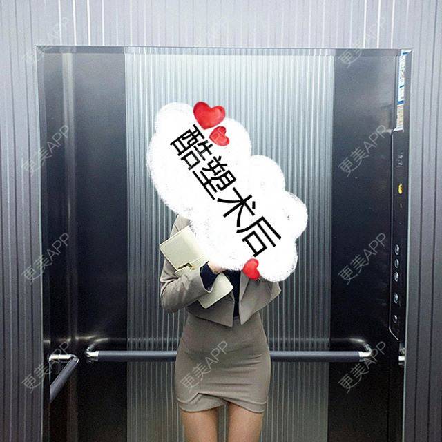 更美 - 更美用户hW4XaCkzge的冷冻减脂瘦腹部经验 | 冷冻减脂瘦臀部 | 冷冻减脂瘦腹部 | 重庆