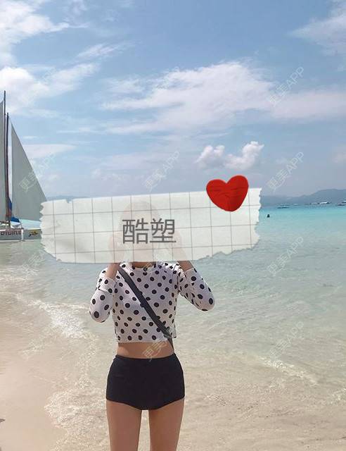 更美 - 更美用户oAH4toi7Az的冷冻减脂瘦腹部经验 | 冷冻减脂瘦腹部 | 重庆