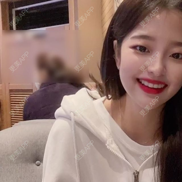 更美 - 更美用户6QHiI6rfFP的全瓷牙经验 | 北京 | 全瓷牙