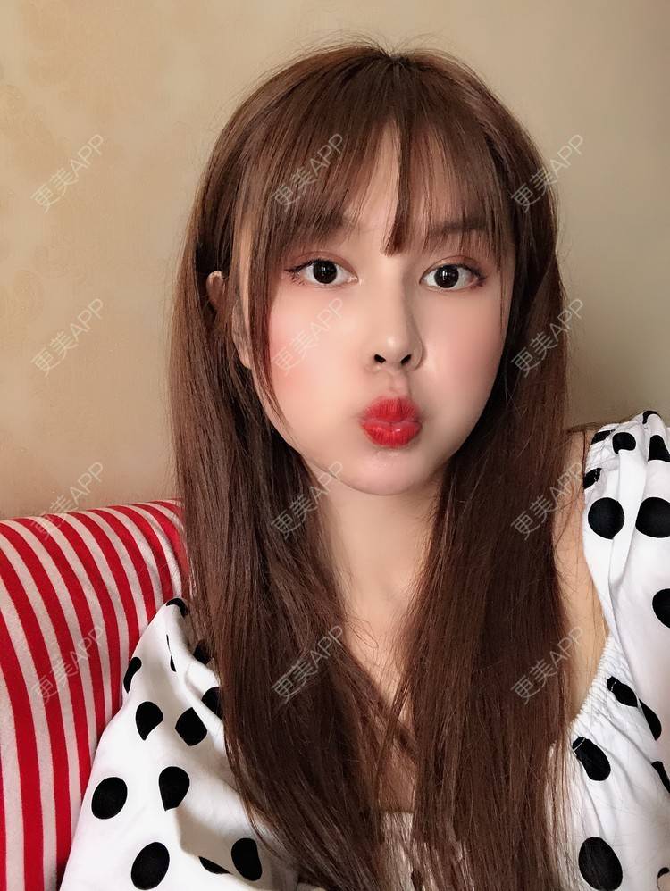 更美 - 更美用户LwBIwddh1C的皮秒激光经验 | 皮秒激光 | 武汉