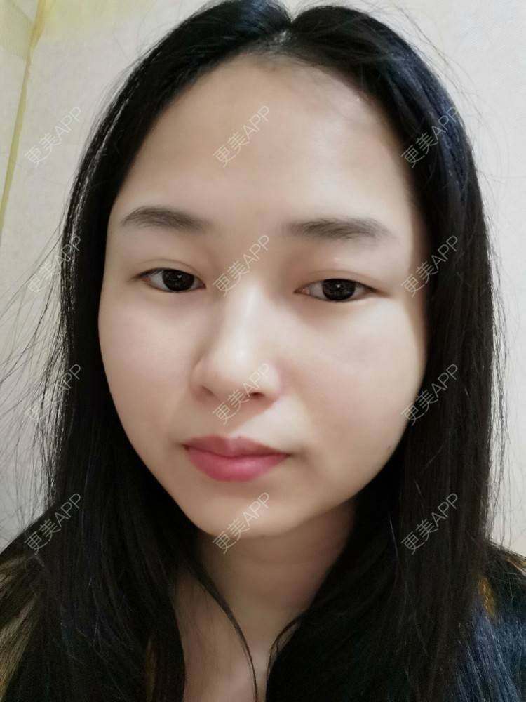 更美 - 小桃桃源的清洁水光补水经验 | 皮肤综合管理套餐 | 广州 | 清洁水光补水