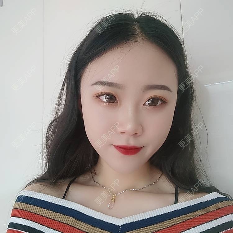 更美 - 更美用户vFETzv4uga的自体脂肪全面部填充经验 | 广州 | 自体脂肪全面部填充 | 视频日记