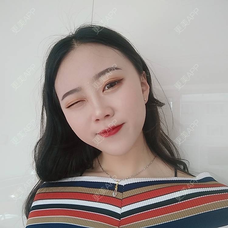 更美 - 更美用户vFETzv4uga的自体脂肪全面部填充经验 | 广州 | 自体脂肪全面部填充 | 视频日记