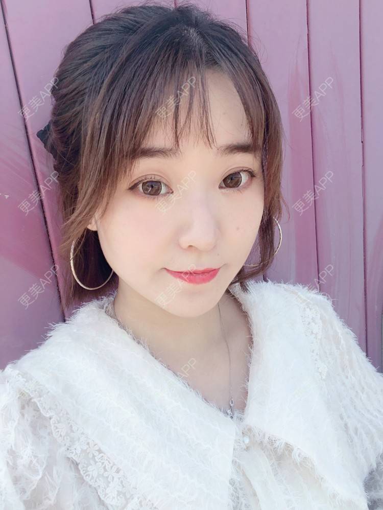 更美 - 田小雕的除皱瘦脸经验 | 除皱瘦脸 | 宁波