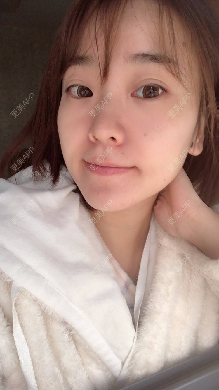 更美 - 田小雕的热玛吉经验 | 热玛吉 | 宁波