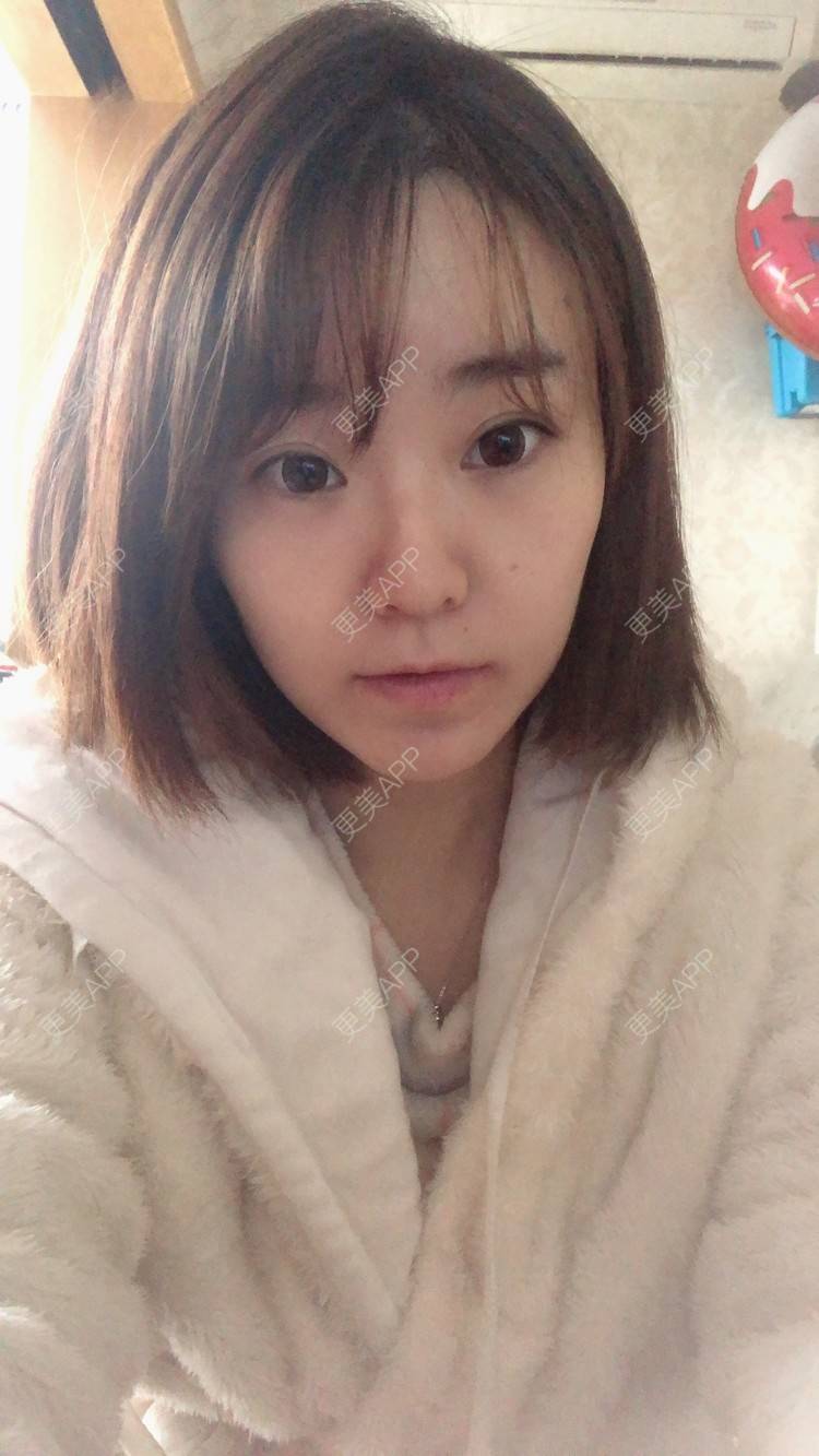 更美 - 田小雕的热玛吉经验 | 热玛吉 | 宁波